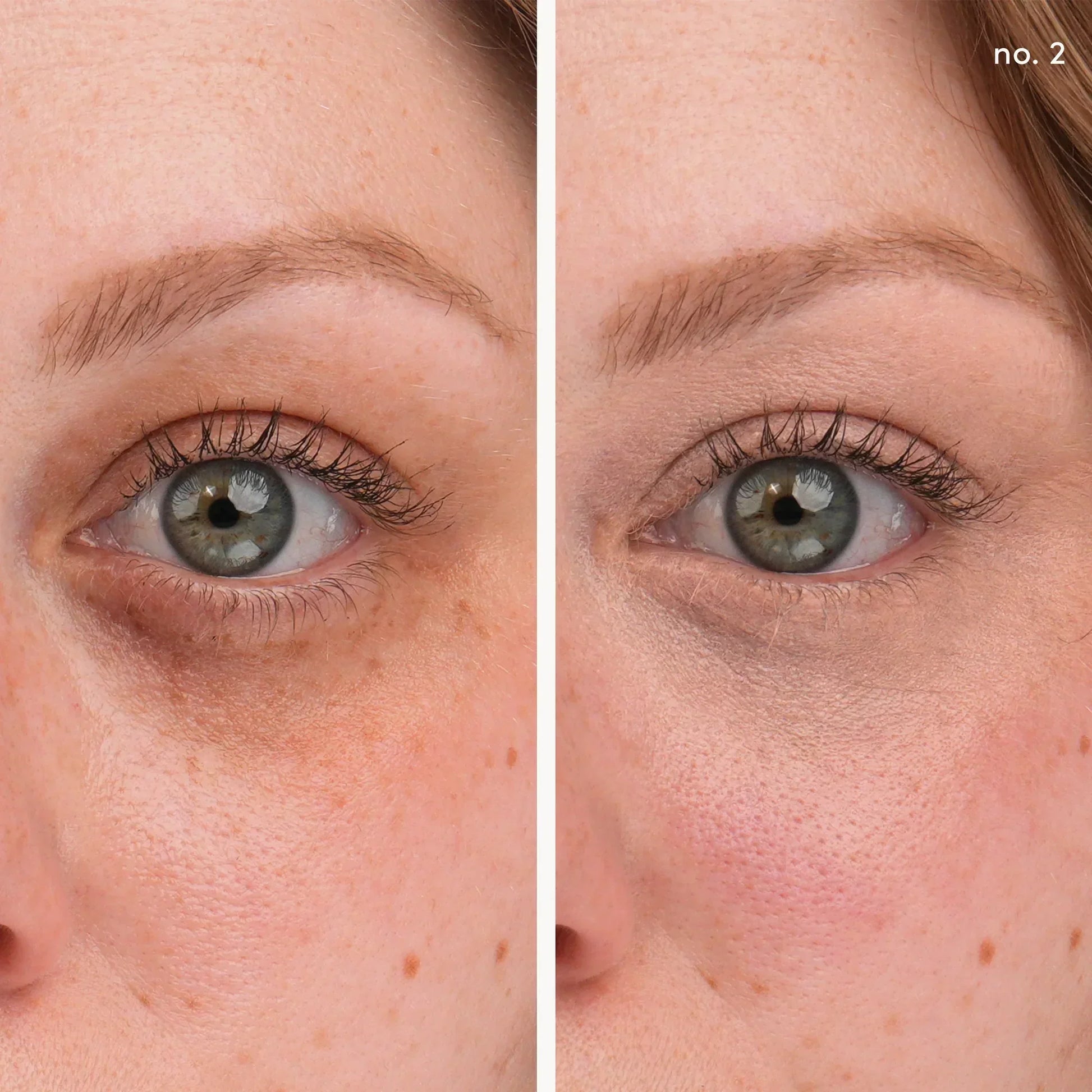 Circle\Delete Concealer 2
