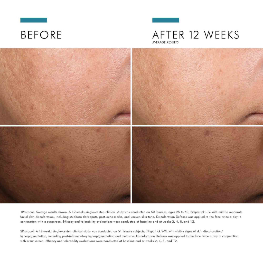 Discoloration Defense Correcting Serum 1 oz