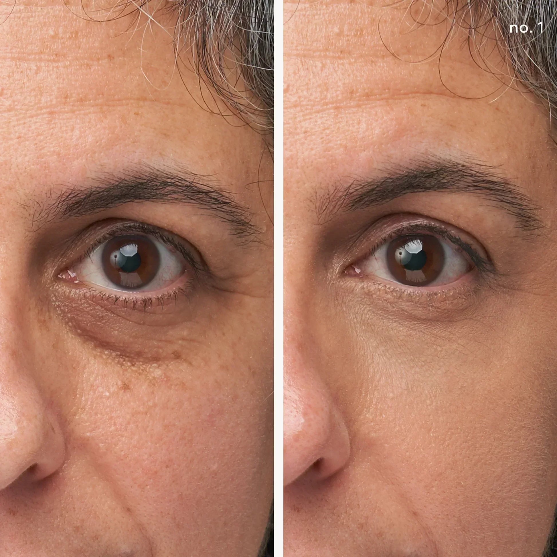 Enlighten Plus Under-eye Concealer