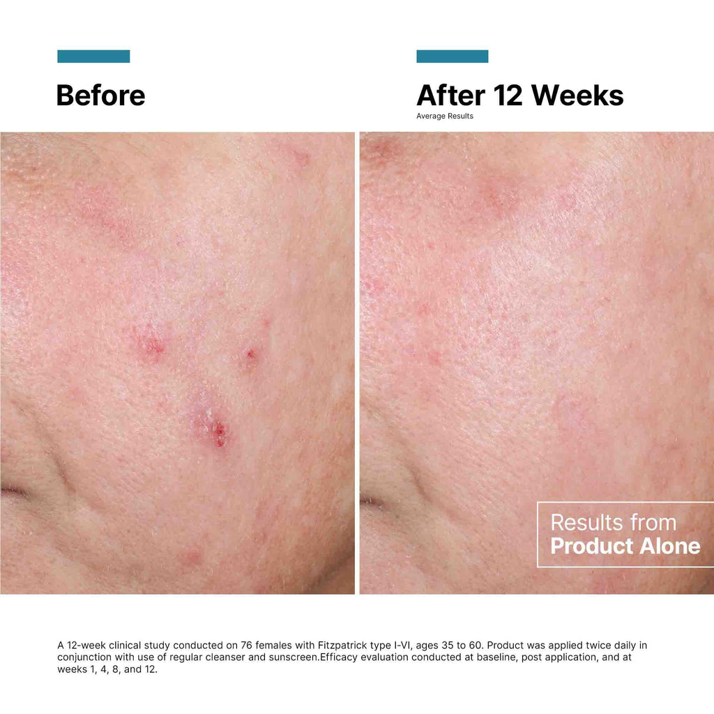 Advanced RGN-6 Skin Regeneration Cream 1.7 oz