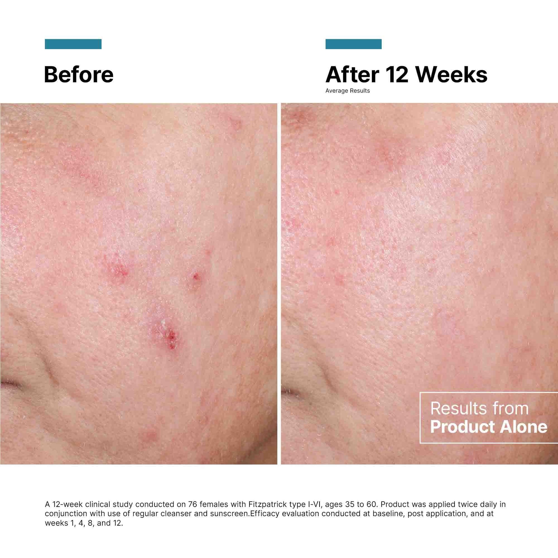 Advanced RGN-6 Skin Regeneration Cream 1.7 oz