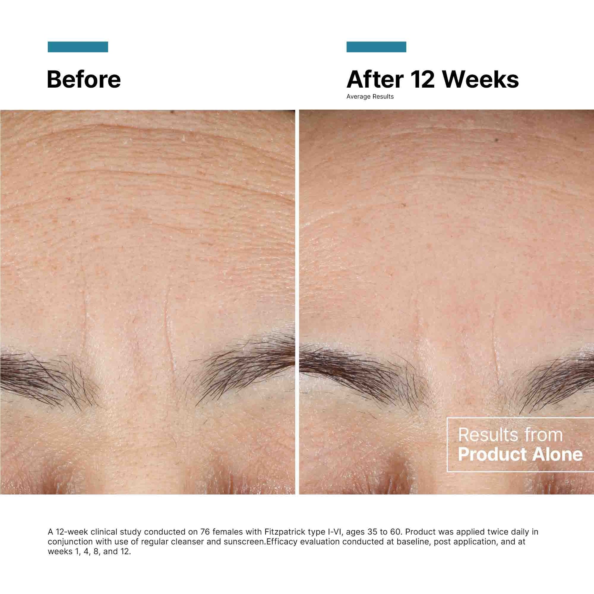 Advanced RGN-6 Skin Regeneration Cream 1.7 oz
