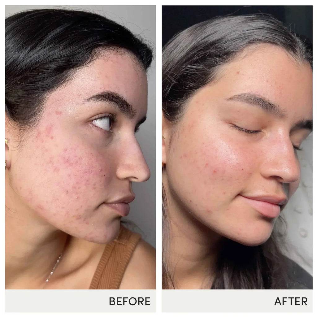 Skin Accumax