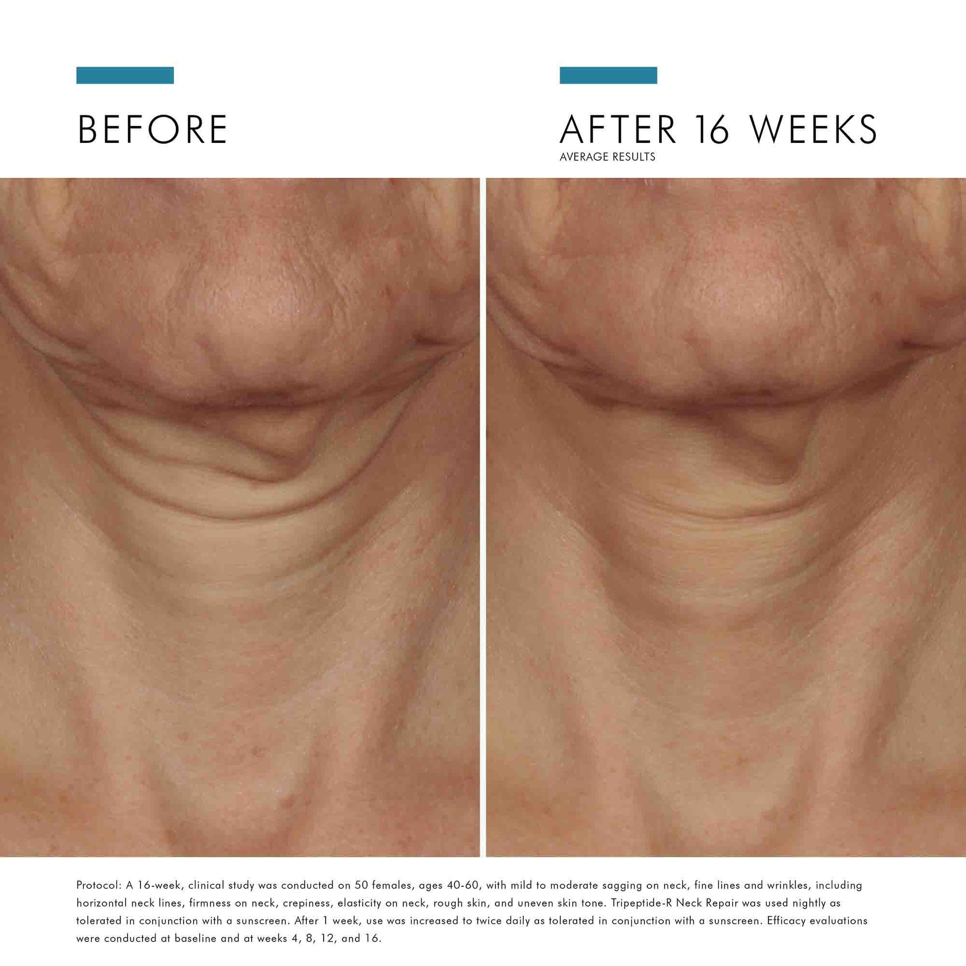Tripeptide-R Neck Repair 1.7 oz