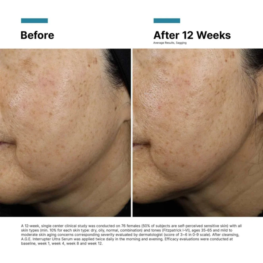 A.G.E. Interrupter Ultra Serum 1 oz